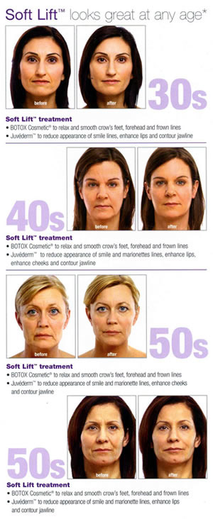 Botox and Juvederm Before And After Pickering DermaSpa